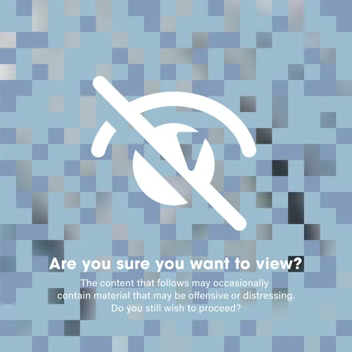 醜形恐怖癥-なるみや